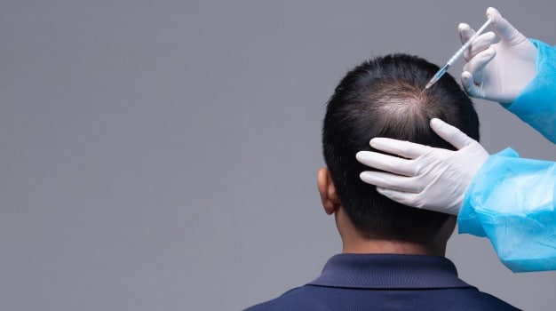 Rambut transplantasi Surabaya Hairtrans